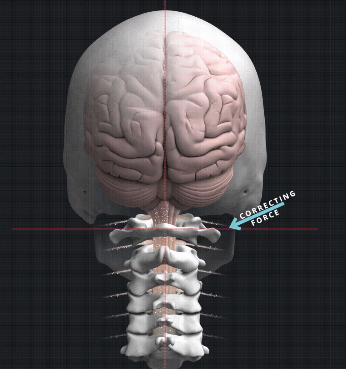 Dr Ryan Klopfer patient education corrective force 3D image