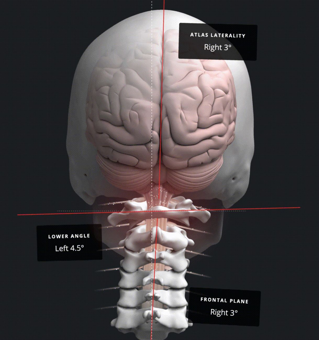 Dr Ryan Klopfer patient education 3D image