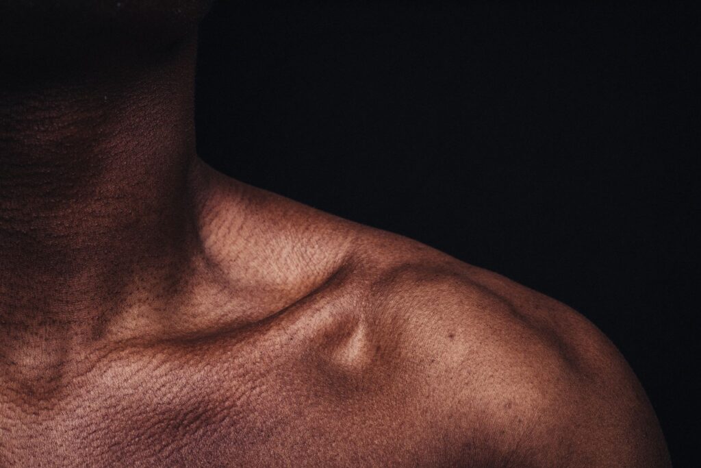 A photo of a collarbone and shoulder