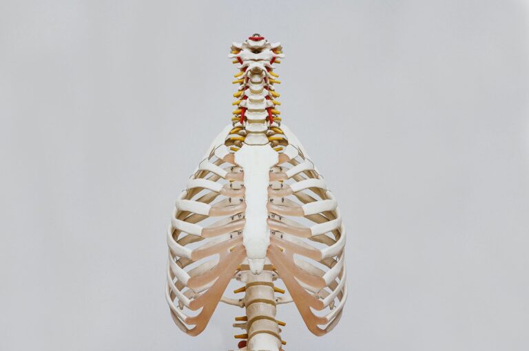 What is a Cervical Rib?